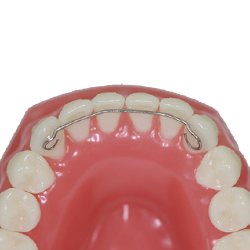 Retainers & Oral Appliances Amherst | Orthodontist | DeMaio Orthodontics